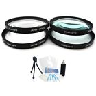 4332156253 Ultrapro Macro Filter Set Bundle And Diopters